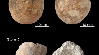 Solving a 12,000-year-old medical mystery